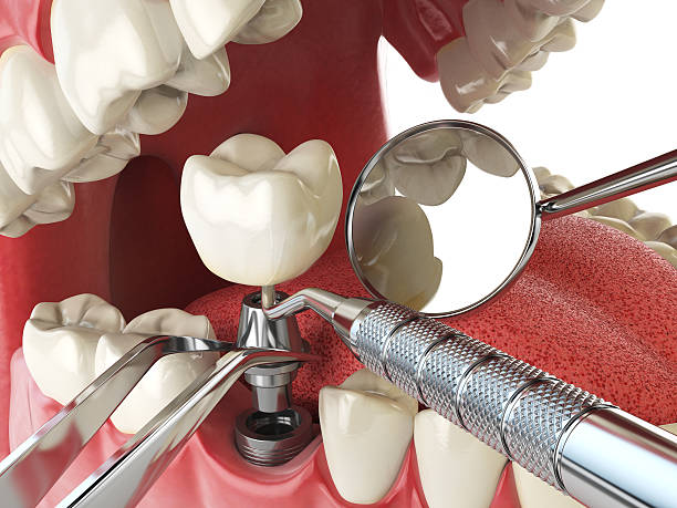Best Broken or Cracked Tooth Emergency Dentist in Violet, LA
