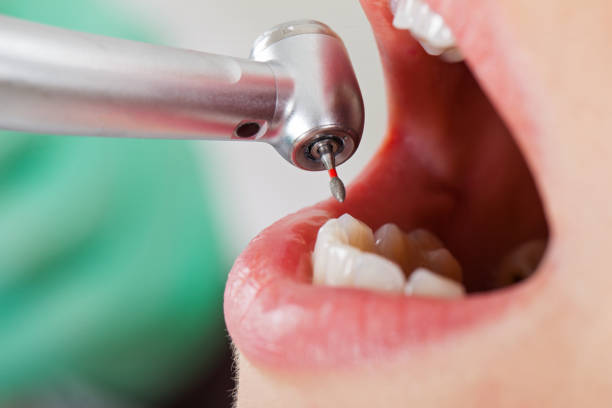 Best Emergency Dentist for Knocked-Out Tooth in Violet, LA